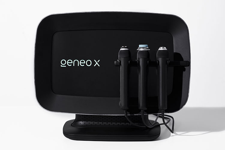ジェネオエックス(GeneoX)
